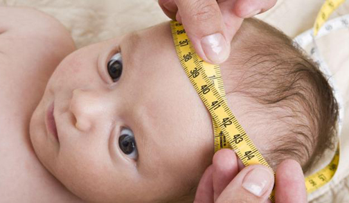 [Photo of the measuring of the circumference of a baby's head]