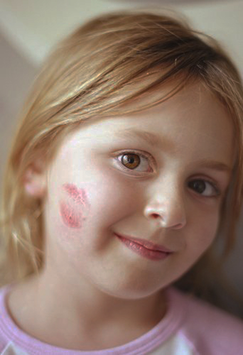 [Photo of a young girl with a lipstick kiss on her cheek]